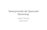 Tenosynovitis de Quervain Stenosing