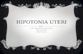 Hipotonia Uteri