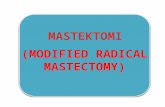 Instek mastektomy