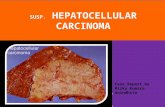 Hepatocellular Carcinoma Case-study