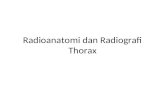 Radioanatomi Dan Radiografi Thorax