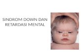 Sindrom Down Dan Retardasi Mental