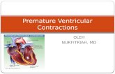Premature Ventricular ContractionsPPT FIX