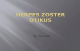 Herpes Zoster Otikus 2 Copy