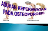 Ppt Osteoporosis lansia by ika yes