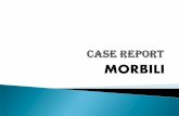 153750604 Case Report Campak