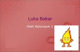 Slide Luka Bakar