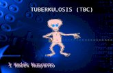 TUBERKULOSIS (TBC)