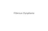 Fibrous Dysplasia