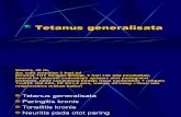 Tetanus Generalisata