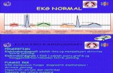 EKG dan rekam jantung Normal