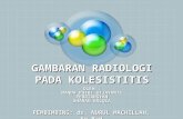 Presentasi Referat Radiologi