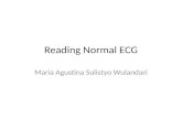 Reading Normal ECG - Maria A.S.W