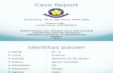 Ppt Case Report Kulit Vitiligo