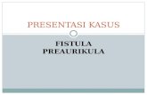 Fistula PRESUS