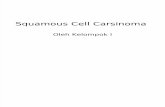 Squamous Cell Carsinoma