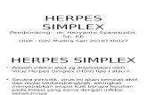 Refreshing hersep simplex