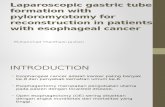 Laparoscopic Gastric Tube Formation With Pyloromyotomy for Reconstruction