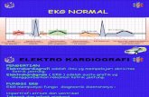 Ekg Normal (118)