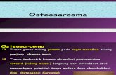 Osteosarcoma Ppt