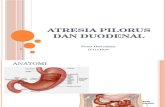 Atresia Pilorus Dan Duodenal