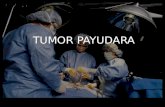 tumor payudara-Aldi.ppt