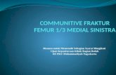 communitive fraktur femur 1/3 medial sinistra