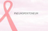 Ekspertise Pneumoperitoneum & CA Colon - Nita
