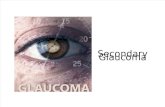 Dislokasi Lensa, Katarak Induce Glaukoma