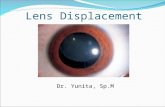 Lens Displacement
