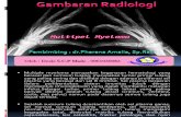Referat  Radiologi Multiple Myeloma dr.Pherena Amalila, Sp.Rad