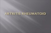 Artritis Rheumatoid