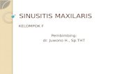 4. Sinusitis Maxilaris