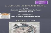 Lupus Serebral Sle