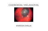Choroidal melanoma