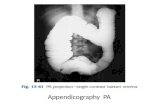 ppt kritisi dan evaluasi radiograf Appendicografi