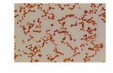 Anemia Aplastik · PDF filebanyak jaringan ikat dan jaringan lemak, dengan aplasi sistem eritropoetik,granulopoetik dan trombopoetik . 1.Tata laksana suportif