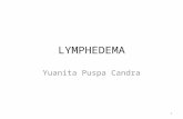 LYMPHEDEMA - FK UWKS 2012 C | born to be a …€¦ · PPT file · Web view · 2016-01-08Limfedema sekunder: semua yg disebabkan krn proses presipitasi (filaria, streptococcus,