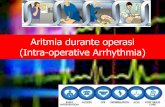 Aritmia durante operasi (Intra-operative Arrhythmia) · Berikan oksigen 100 persen dan pastikan bahwa nafas buatan ... Asistol . a state of no ... DC shock • 3. Tempelkan di dada,