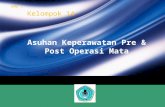 Asuhan Keperawatan Pre & Post Operasi Mata · PPT file · Web view2012-05-05 · Pre & Post Operasi Mata. Pre Operasi. Perawatanperioperatifharusberadaptasidenganperubahan-perubahanakibatkemajuanteknologidanjugaperubahan