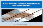 ULTRASONOGRAFI TORAKS PADA EFUSI PLEURA DAN … Cleopas Martin - USG... · 2019-11-25 · EFUSI PLEURA Akumulasi cairan pleura yang abnormal USG lebih sensitif dibandingkan dengan
