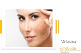 Melasma … · Tratamentos estéticos melasma • • Peeling químico superficial –acretinoico, Jessner- removem pigmento acumulado pele • Lasers: • ND YAG QS –quebra o pigmento