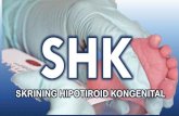 PowerPoint Presentation...•Laboratorium Patologi Klinik RSU dr Soetomo belum ditetapkan untuk menjadi laboratorium rujukan pemeriksaan SHK oleh Kemenkes.tapi sudah dilakukan asesmen