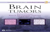 Brain Tumors