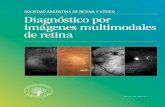 Diagnóstico por imágenes multimodales de retina
