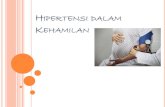 HIPERTENSI DALAM KEHAMILAN - DALAM KEHAMILAN Gestasional Hypertension (GH), yang berarti tekanan darah