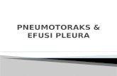 Pneumotoraks & Efusi Pleura