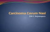 Carcinoma Cavum Nasi